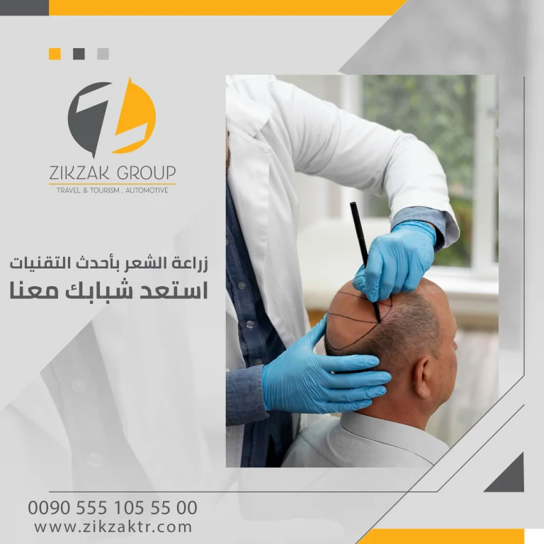 أحدث عمليات زراعة الشعر